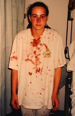 Corinna Horvath, on the night she was assaulted by police (photo by Corinna's mother)